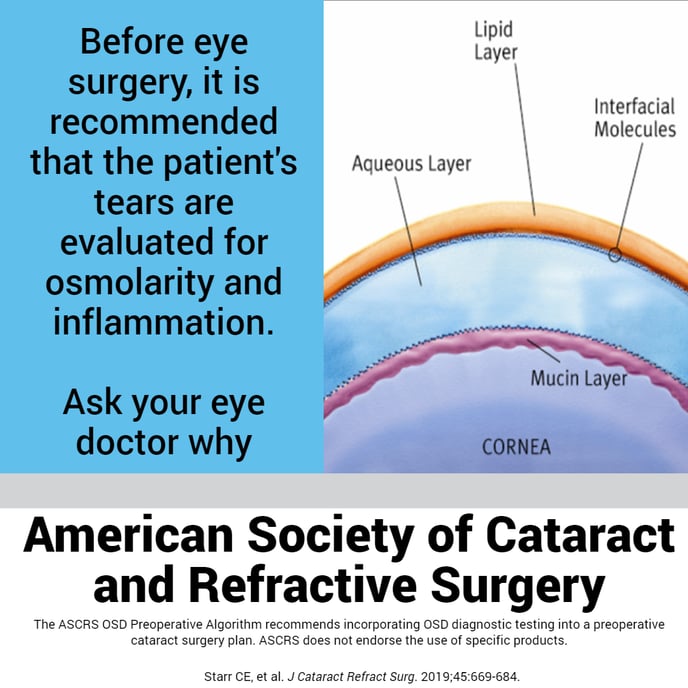 ascrs_preop test_Jun2021